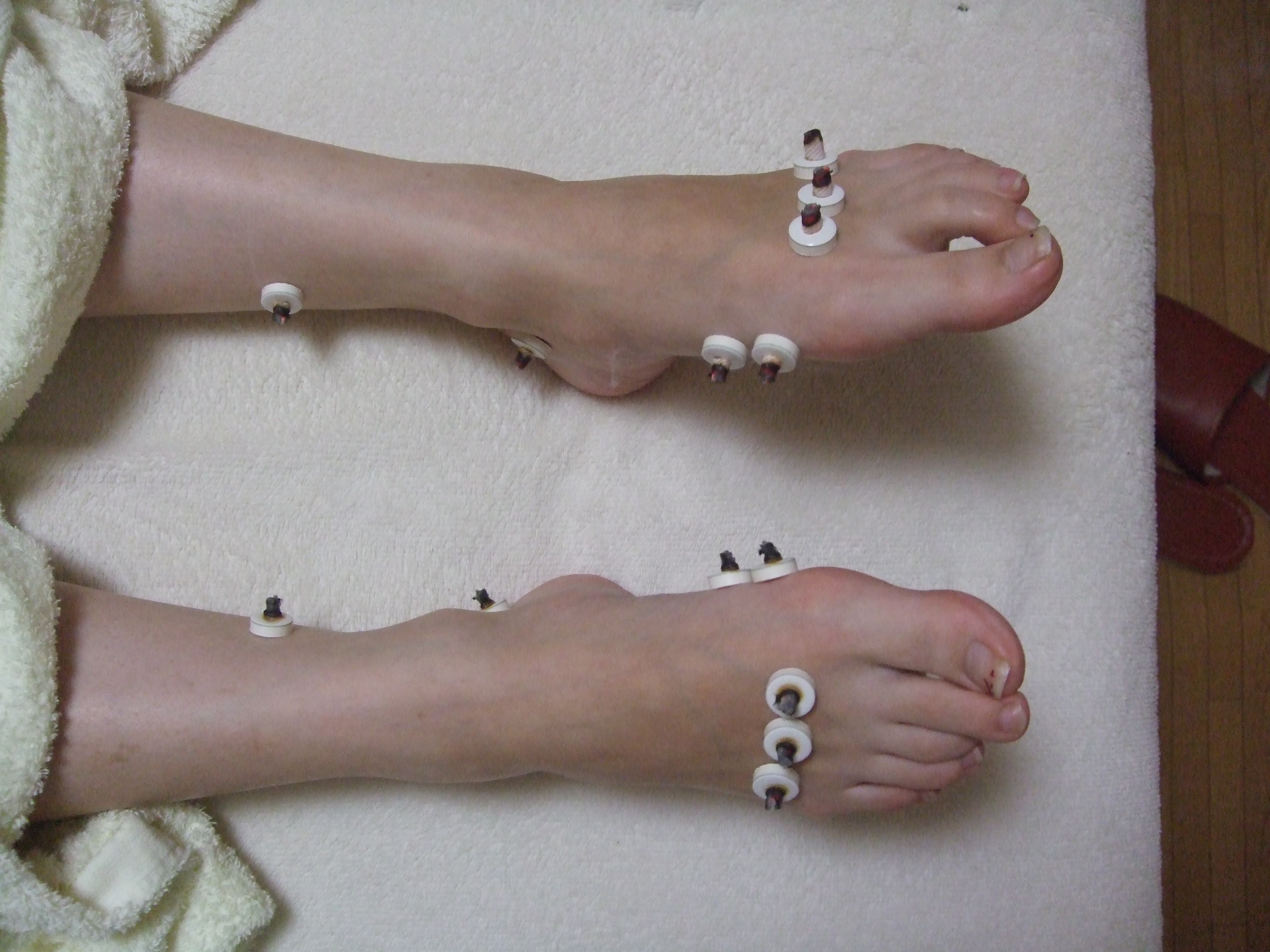 足のお灸の画像