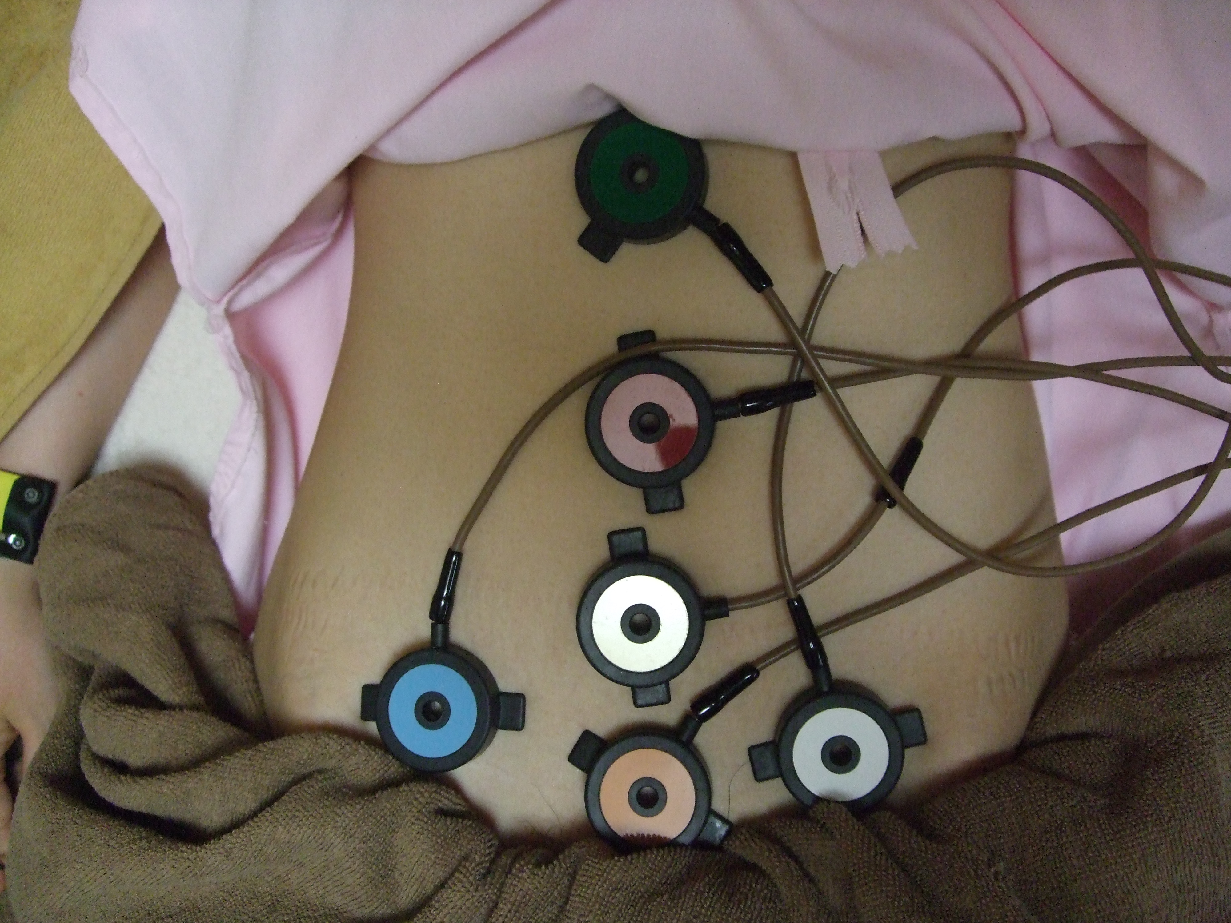 腹部温灸器施術の画像