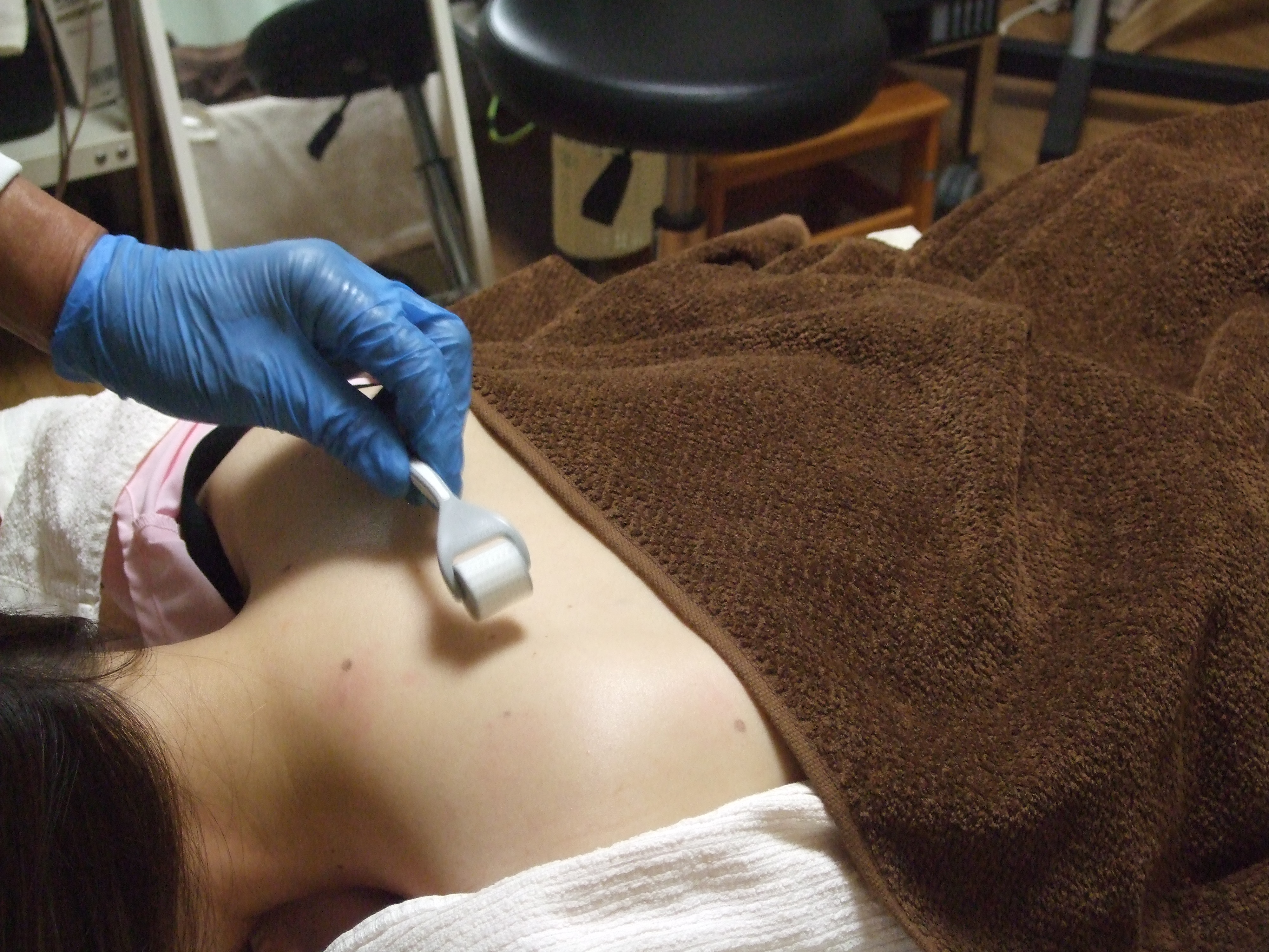 オプション　背中施術　　　　施術費1,000円(税込)の画像