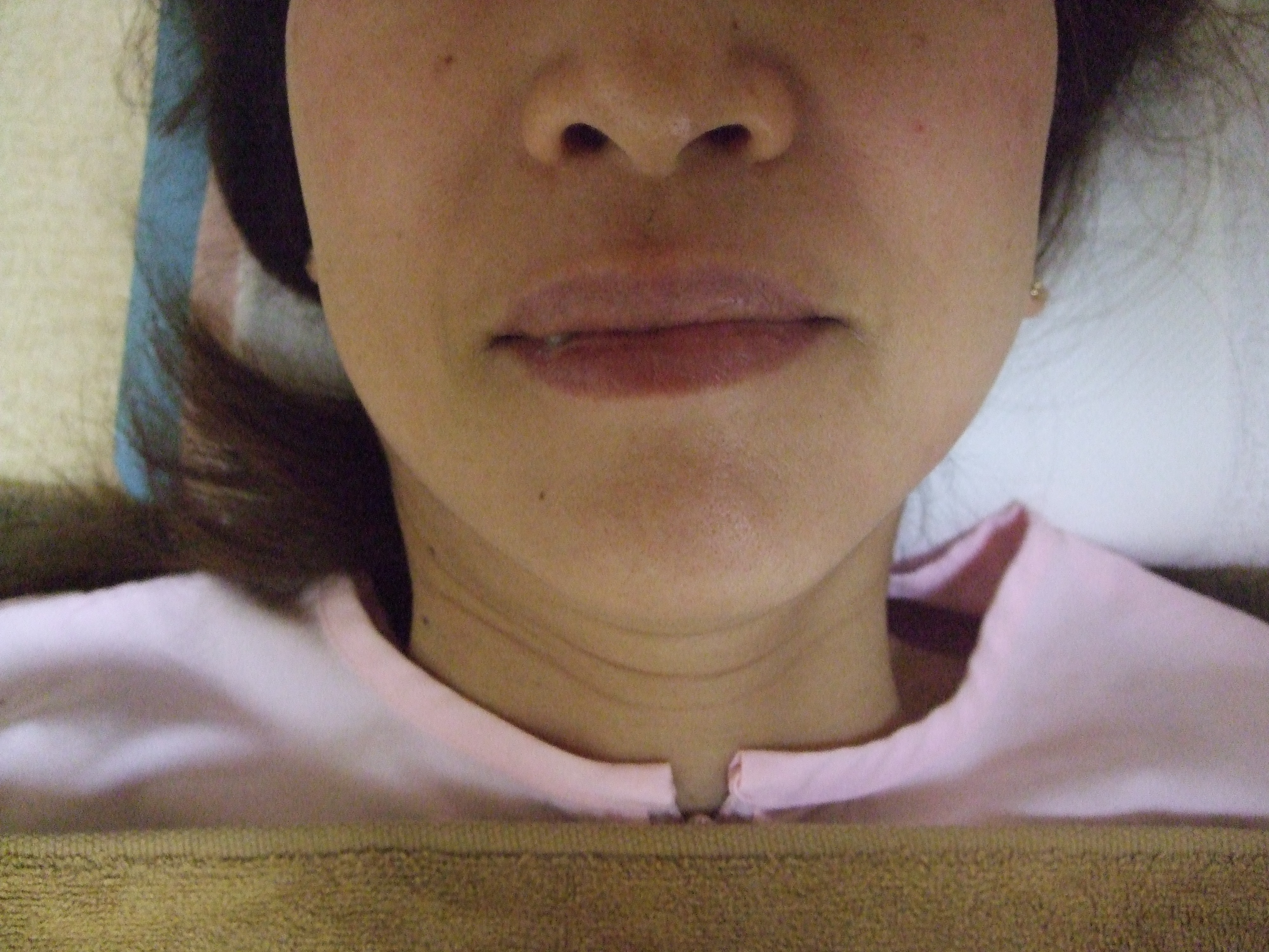 顎整体　の画像