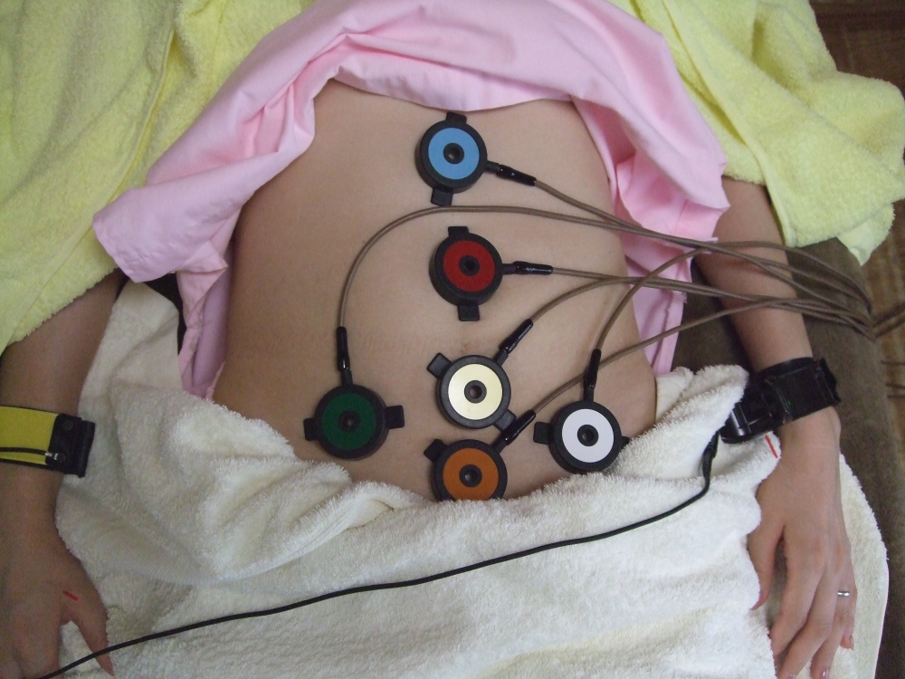 腹部温灸器による温熱施術(心地よい温熱です)を行います。の画像