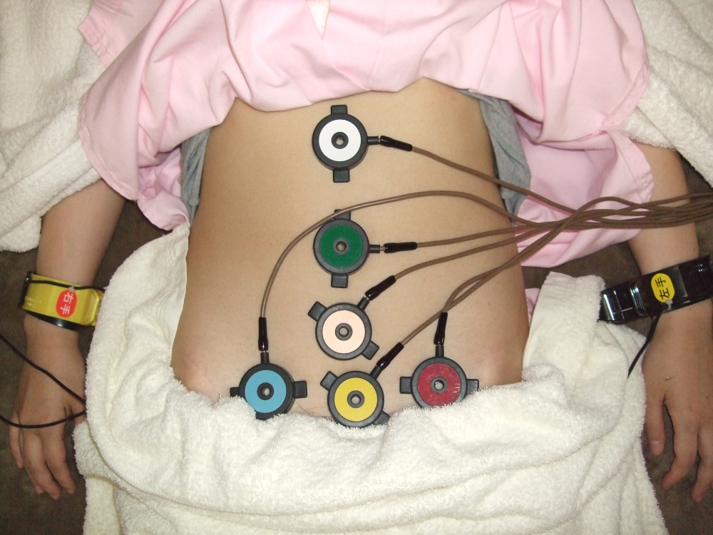 顔面刺鍼後腹部主要なツボへの温熱刺激を行います。の画像