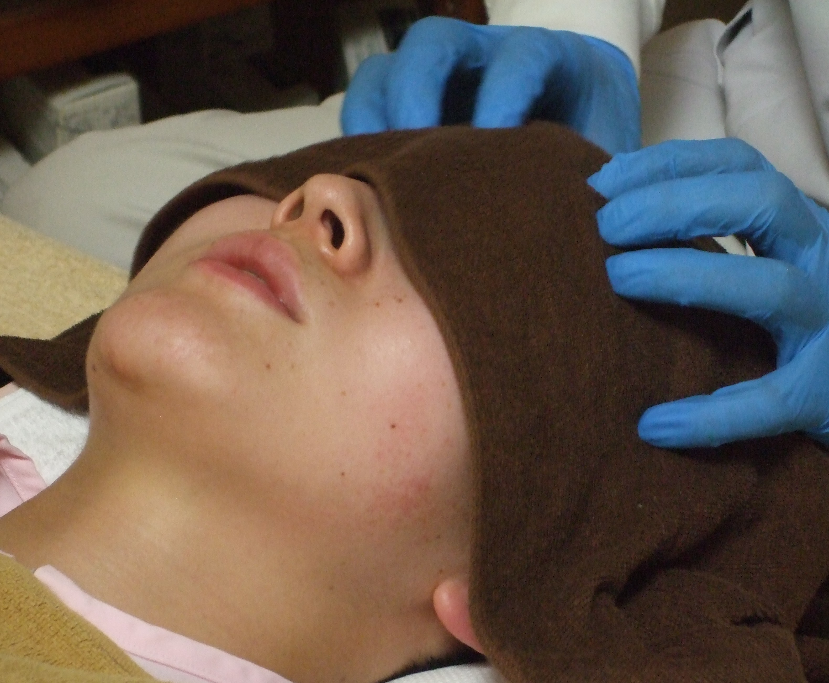 頭皮セラピーの画像