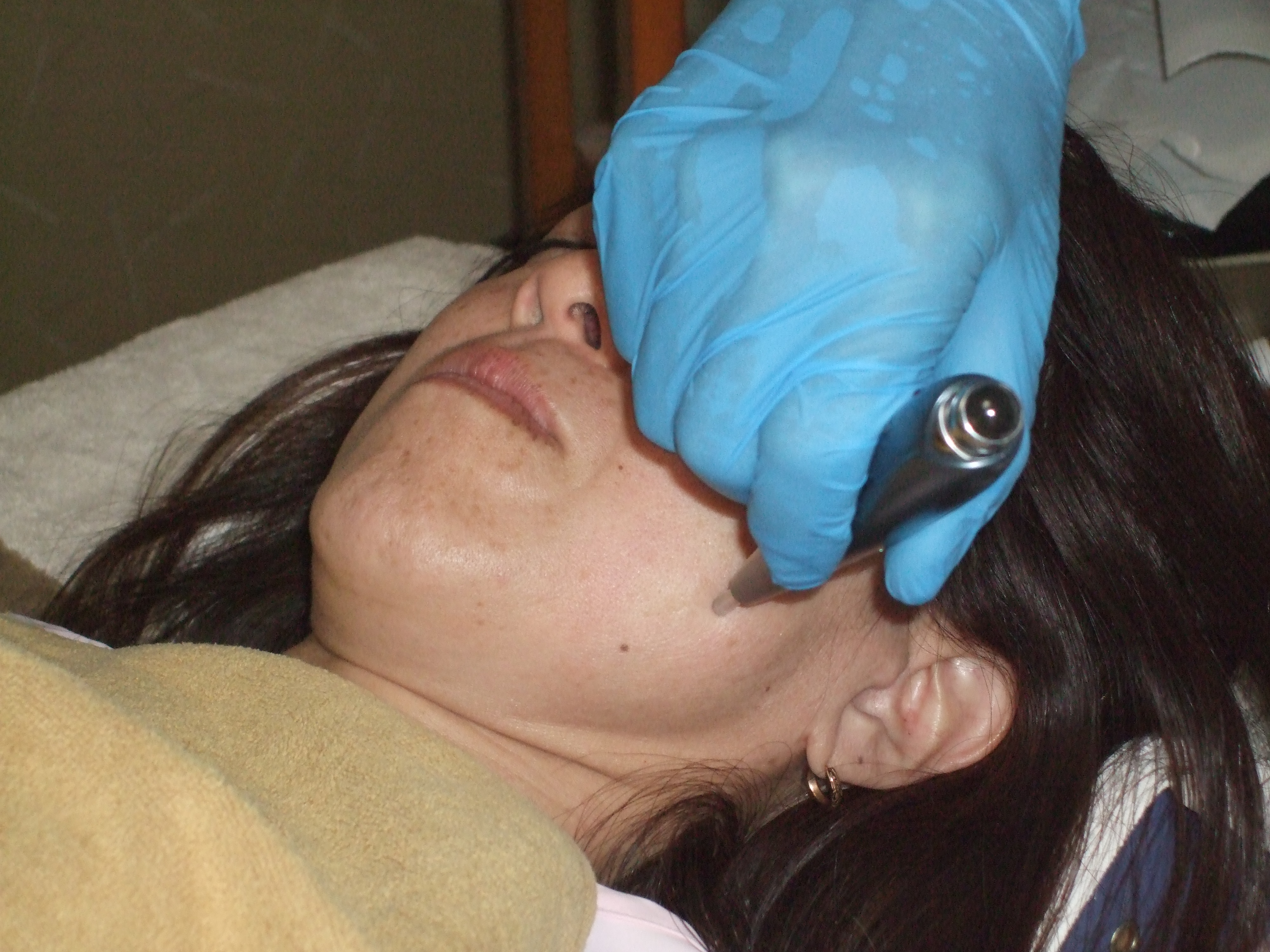 フェンスラインケアの画像