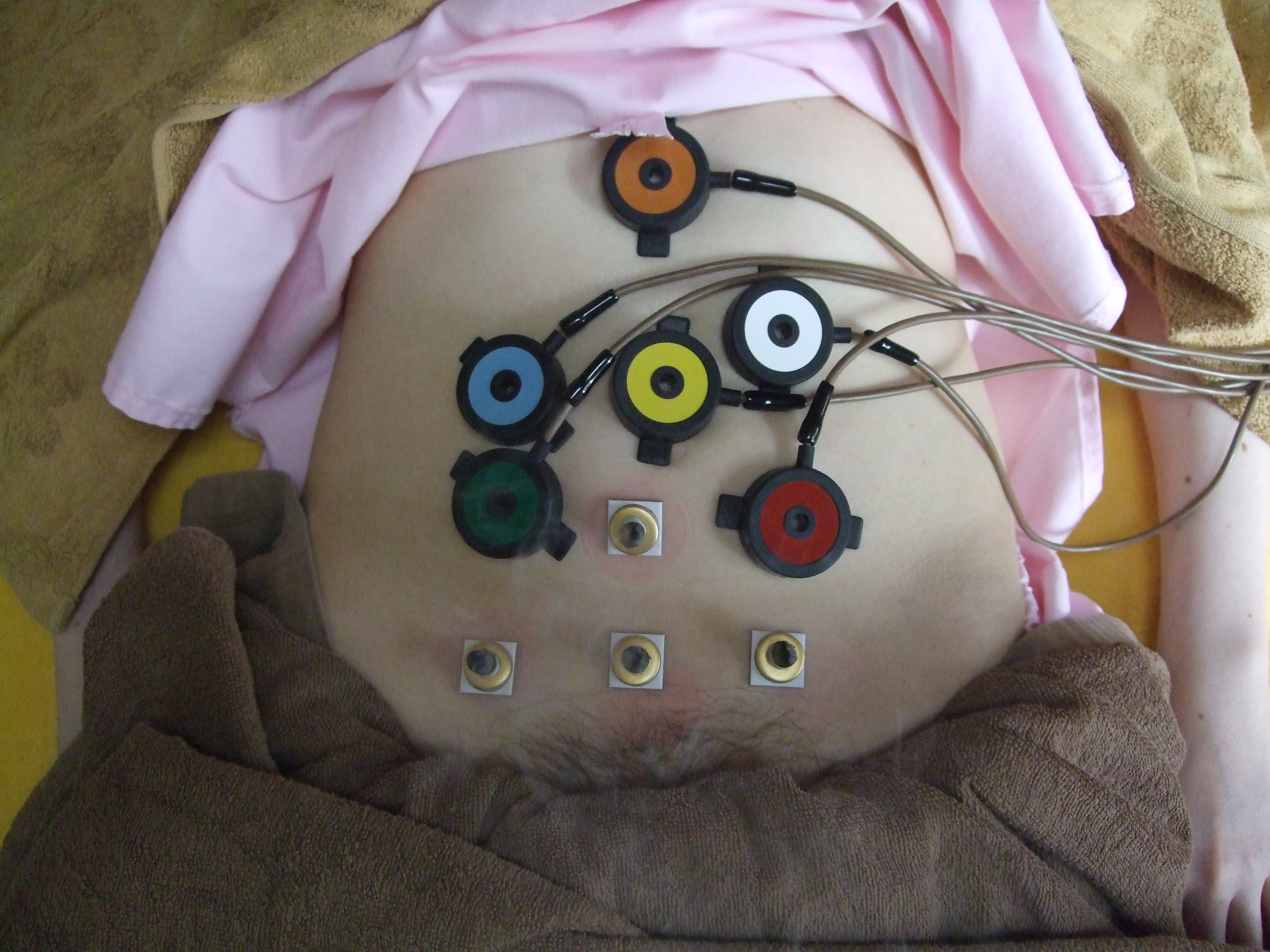 温灸器により腹部主要なツボへ温熱刺激をあたえ、血液などの循環ケアを図っていきます。の画像