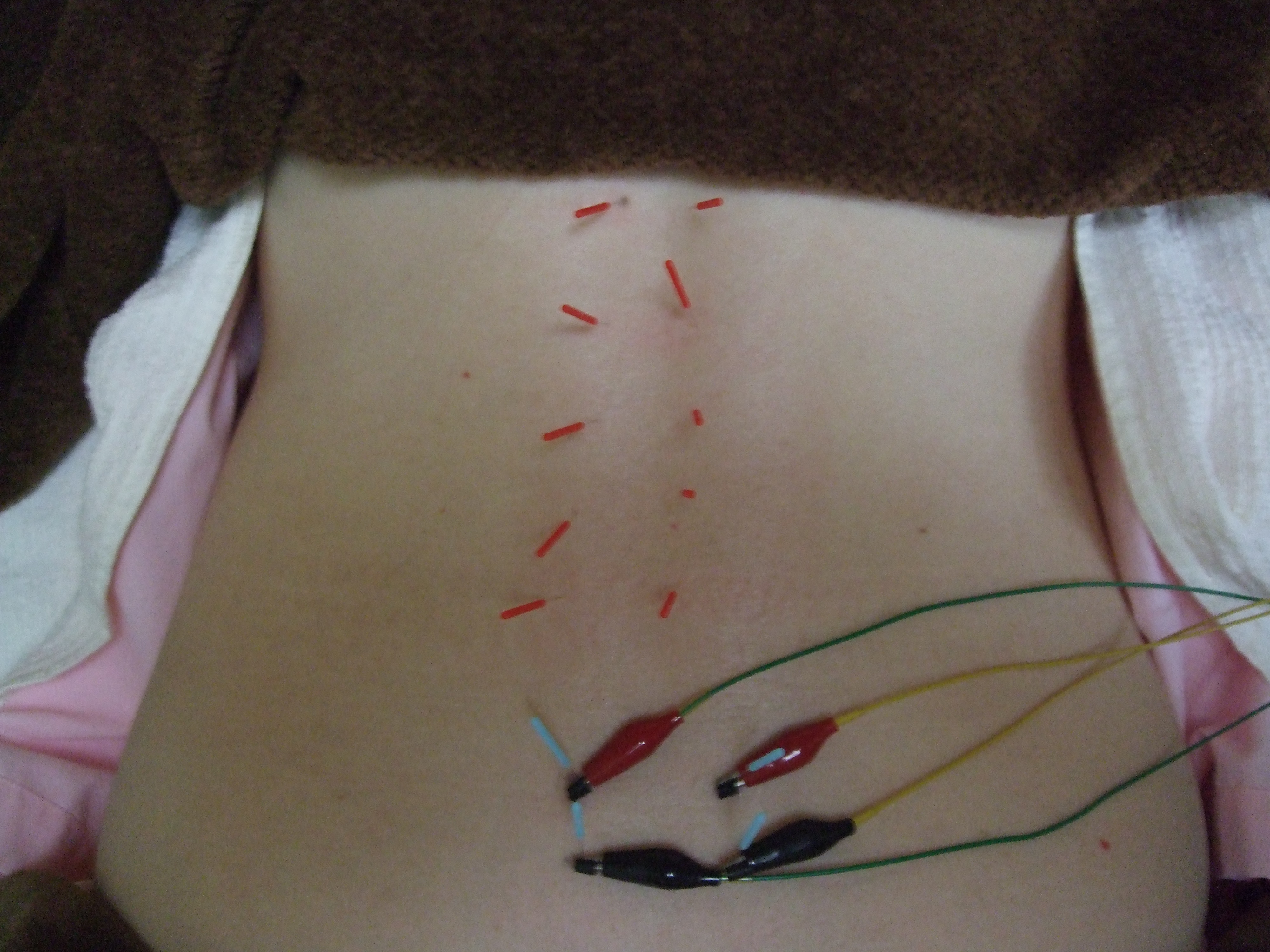 子宮への血流促進の画像