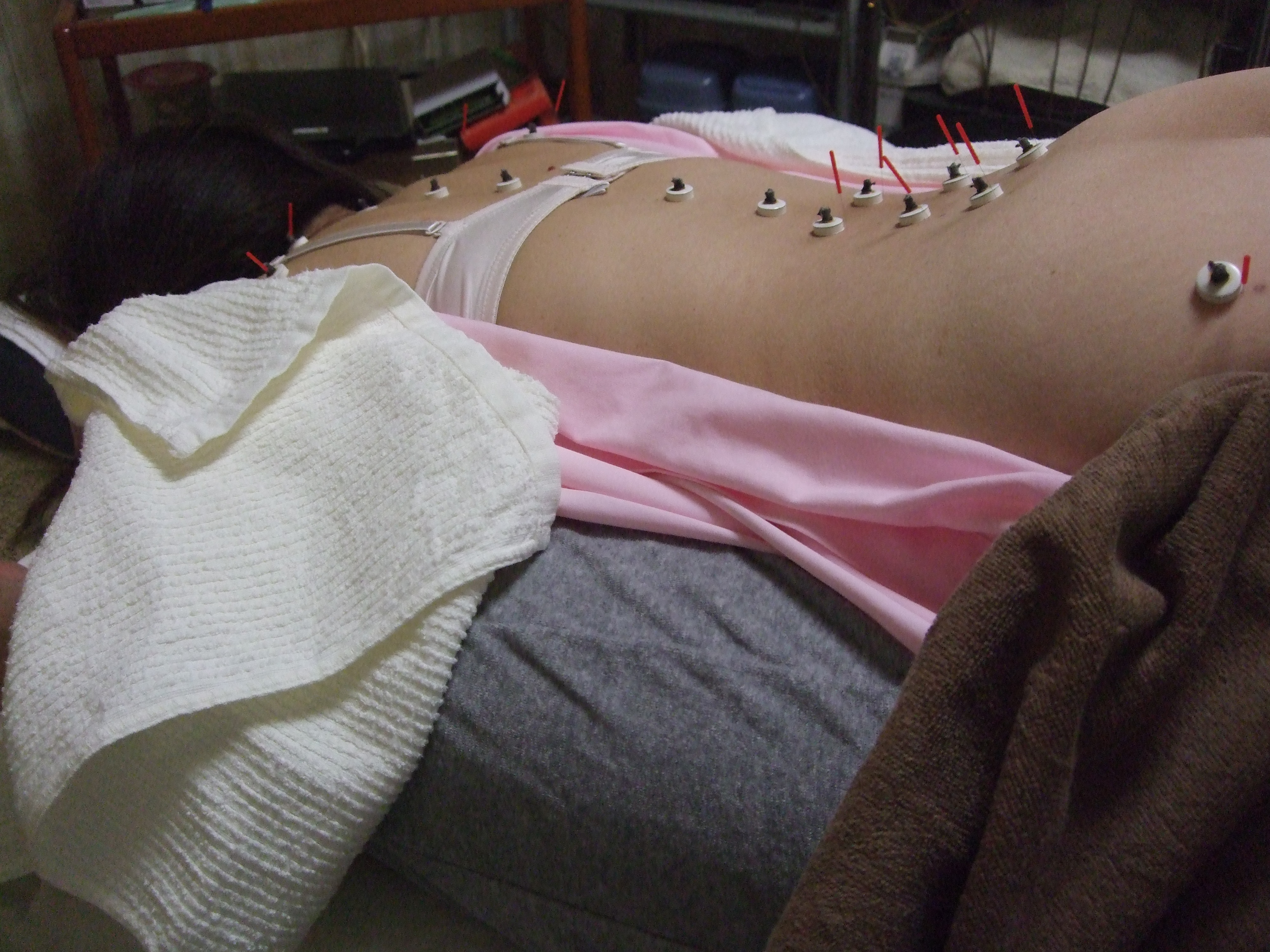 うつぶせまくら使用による背腰部施術の画像