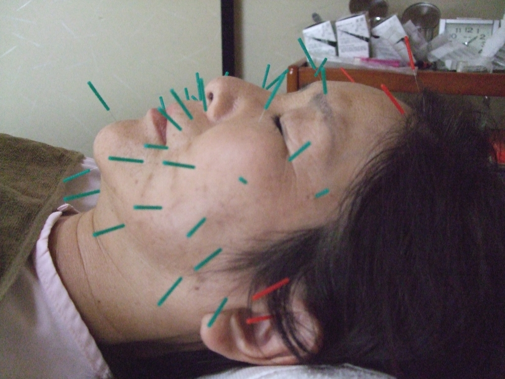 メニューの写真