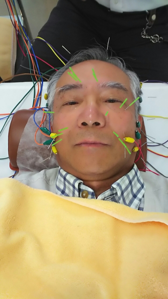 その他の写真