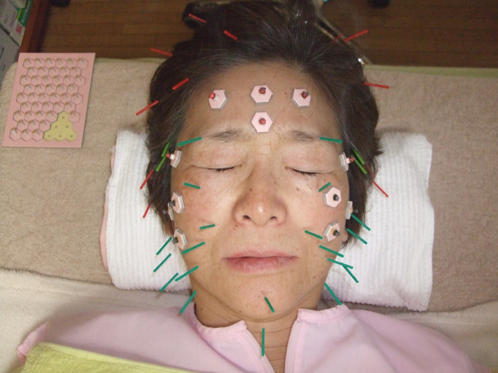 メニューの写真
