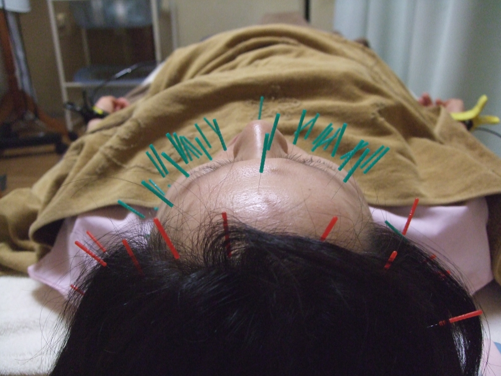 メニューの写真