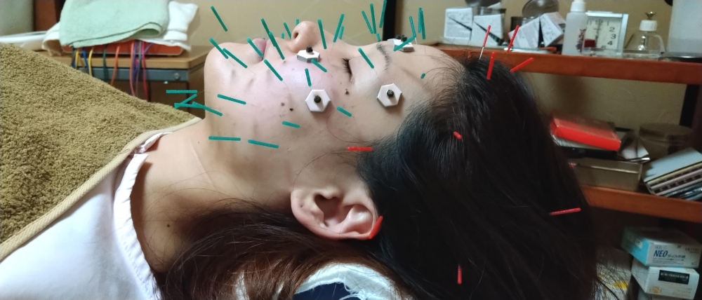 商品の写真