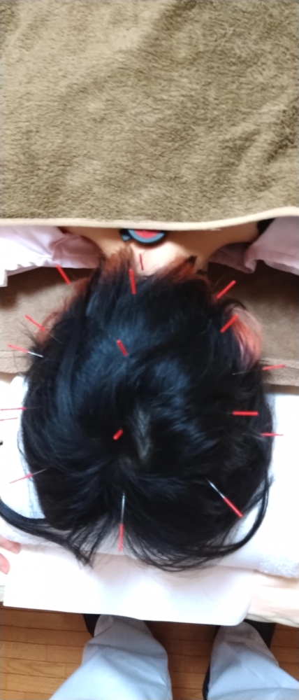 商品の写真